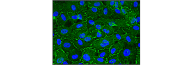 Abb2-Tumorzellfluoreszenzfaerbung